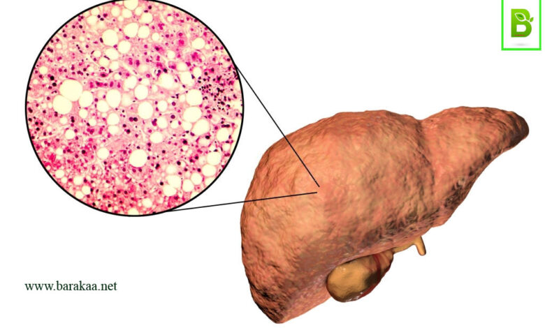 كيفية التخلص من دهون الكبد بالاعشاب