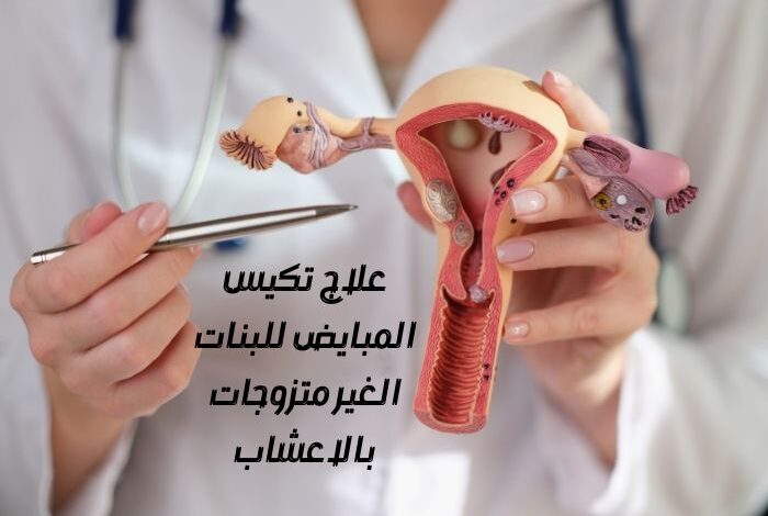 علاج تكيس المبايض للبنات الغير متزوجات بالاعشاب