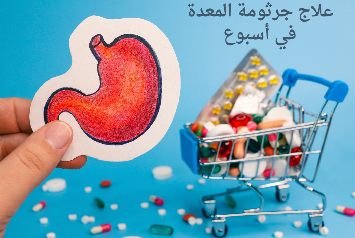 علاج جرثومة المعدة في أسبوع